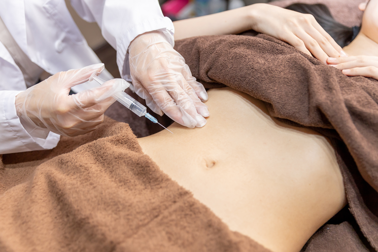 脂肪溶解注射とは