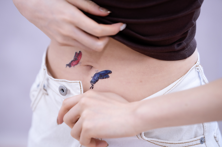 タトゥー・入れ墨の除去について